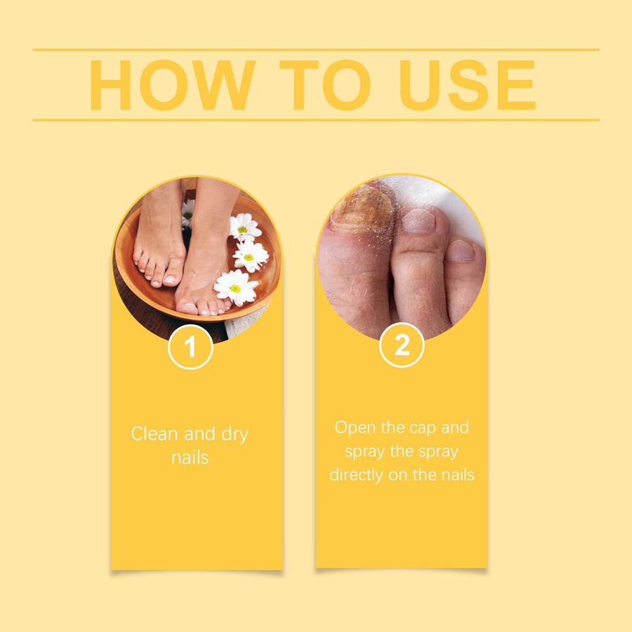 Bee Venom Nail Spray for Fragile, Brittle Nails