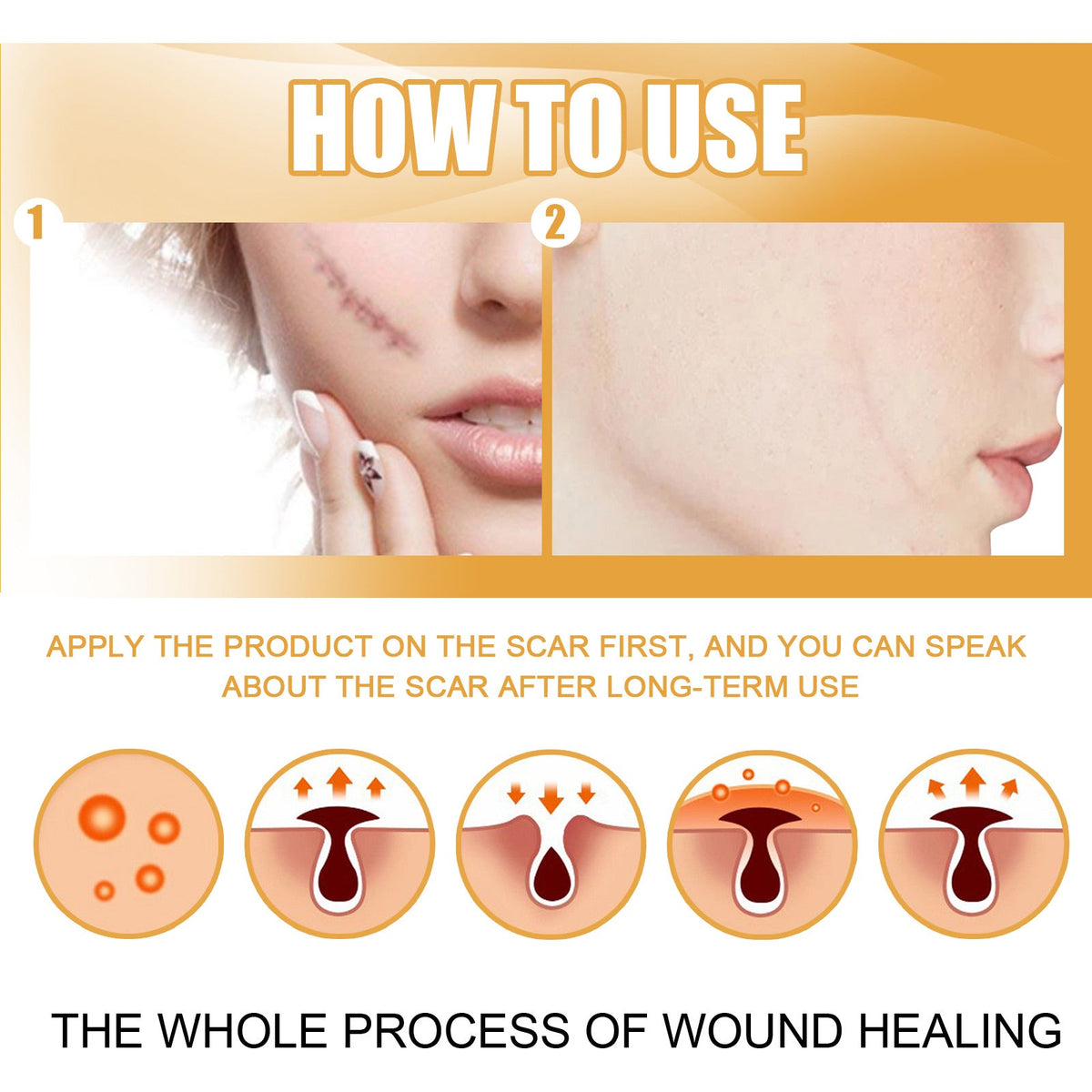 Scar Repair Cream — Fades Scars & Restores Smooth Skin
