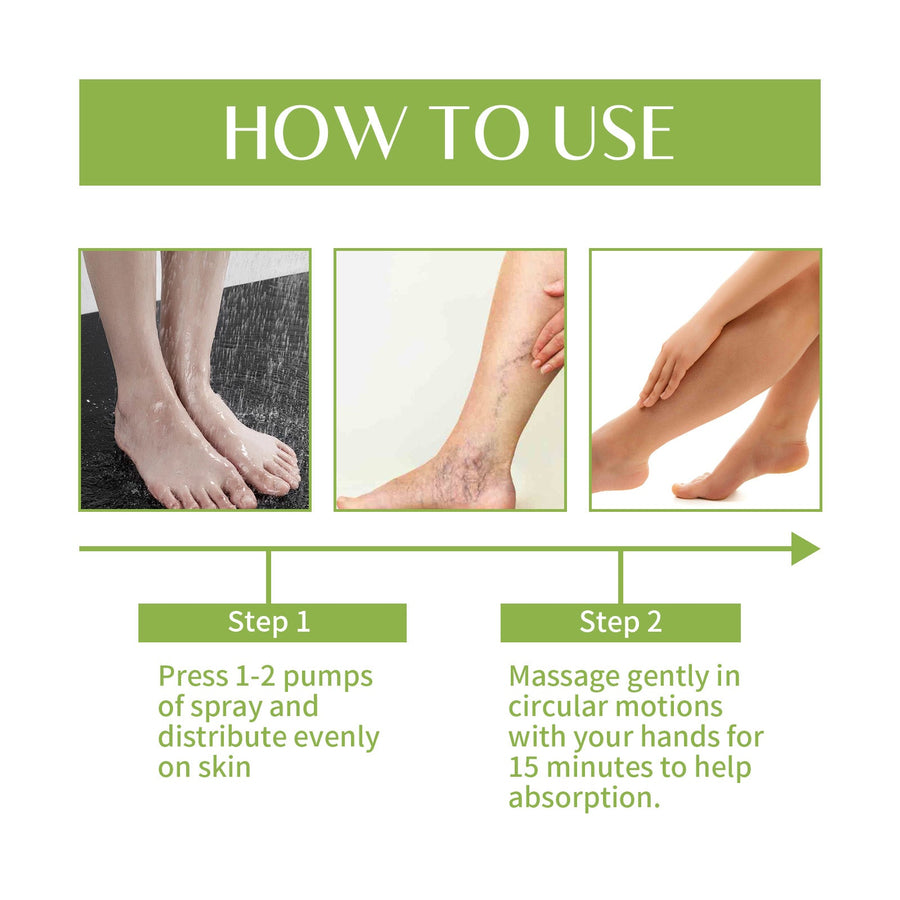 Varicose Veins Relief Spray — Soothe Leg Pain & Restore