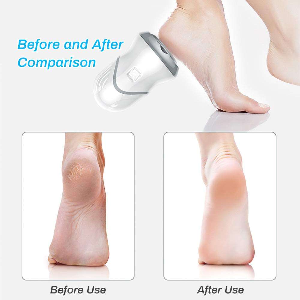 Rechargeable Electric Foot Grinder – Smooth, Callus-Free Feet