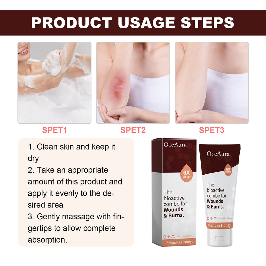 Manuka Honey Wound & Burn Cream, 6X Faster Skin Repair