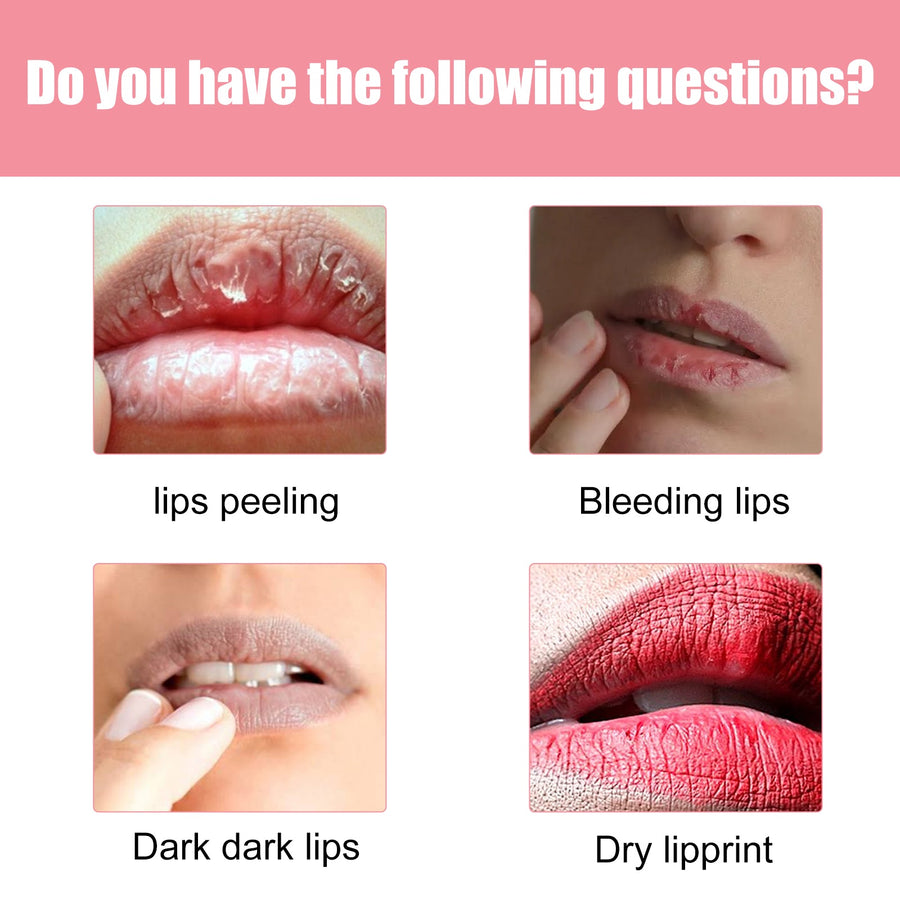 Volumizing Lip Glaze Volumizing Lip Care Desalting Lip Lines