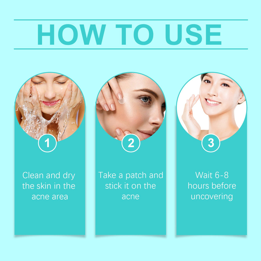 Ouhoe Micropoint Acne Patches for Spots and Blemishes