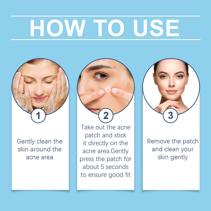 Acne Patches Day & Night 240ct Hydrocolloid Spot Cover