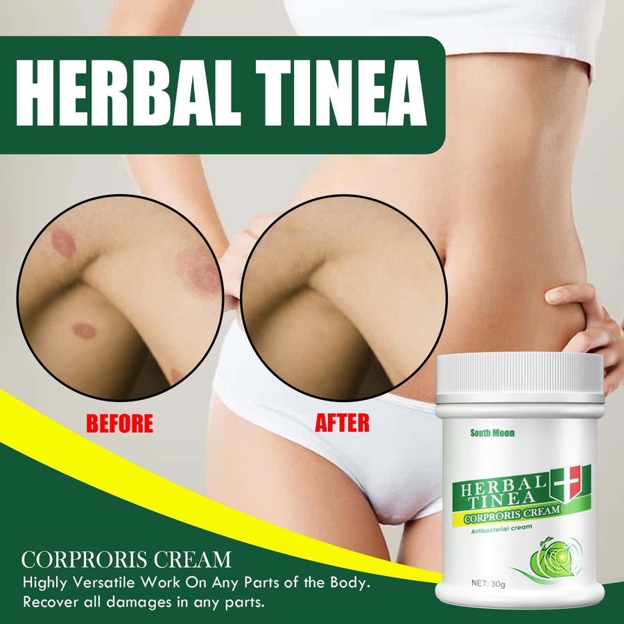 Herbal Tinea Cream for Fungal Itch & Rash Relief