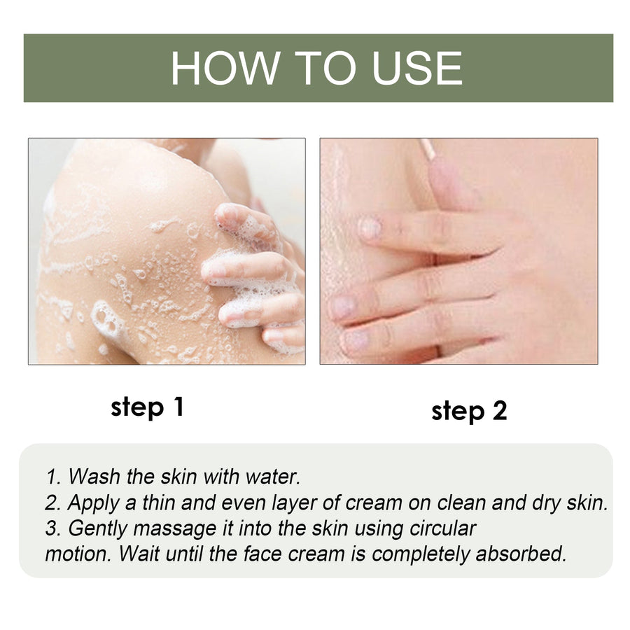 South Moon Body Cream for Keratosis and Dark Spots