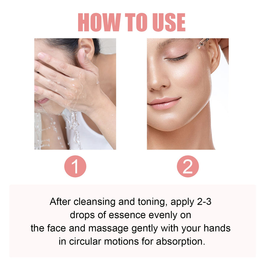 Hoygi Niacinamide Essence 70% for Acne Marks & Dullness