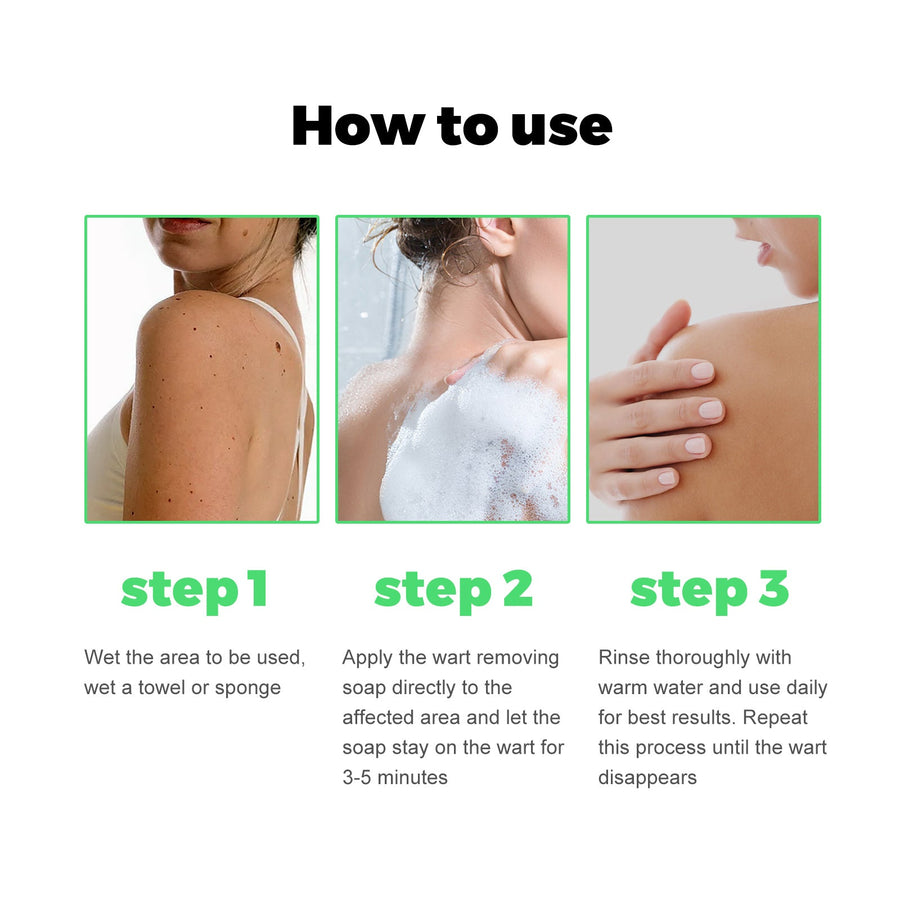 Skin Tag & Wart Removal Soap — Pain & Scar-Free Treatment
