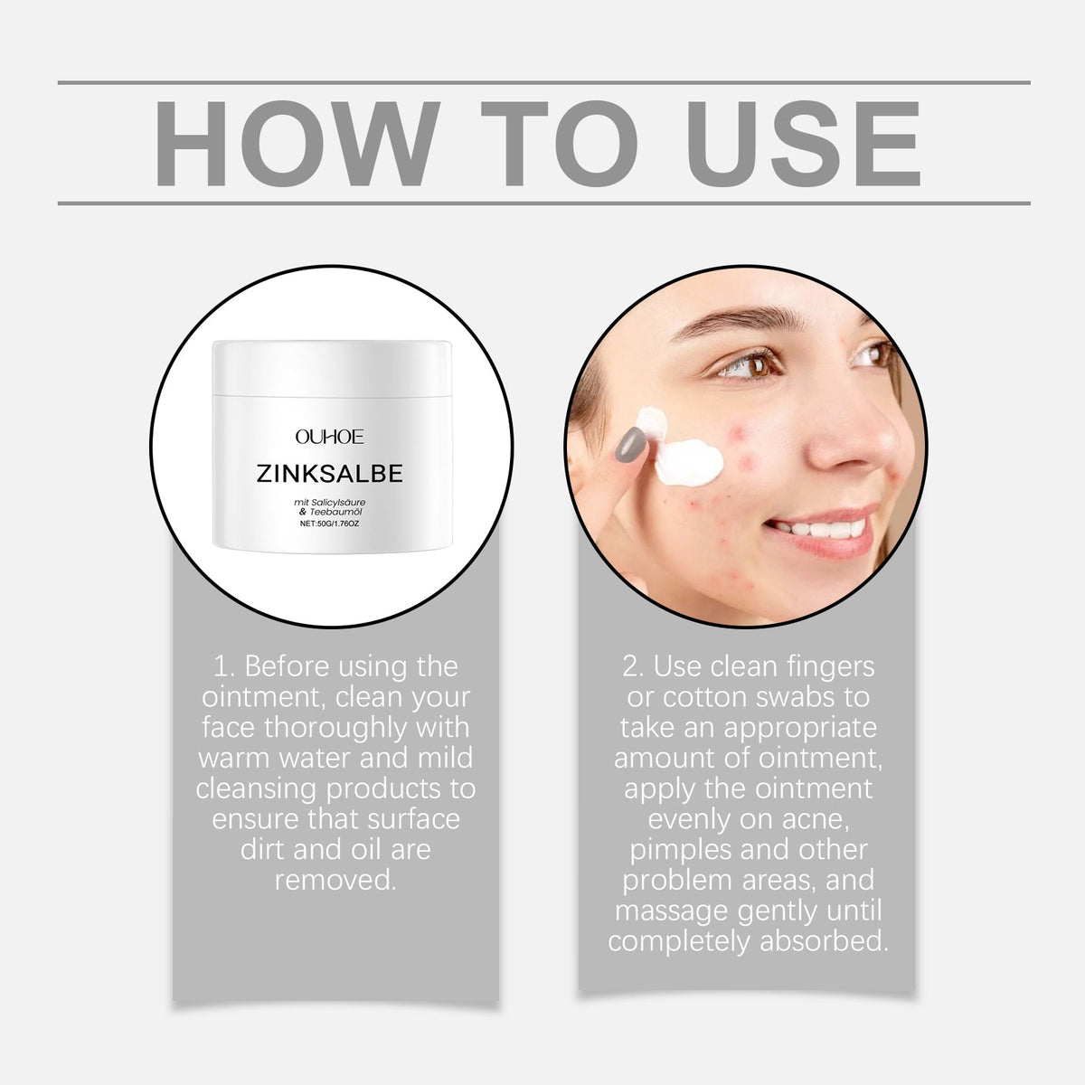 Gentle Acne Cream That Won't Clog Pores