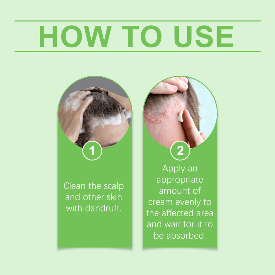 Herbal Seborrheic Dermatitis Cream — Flake-Free Scalp in 4