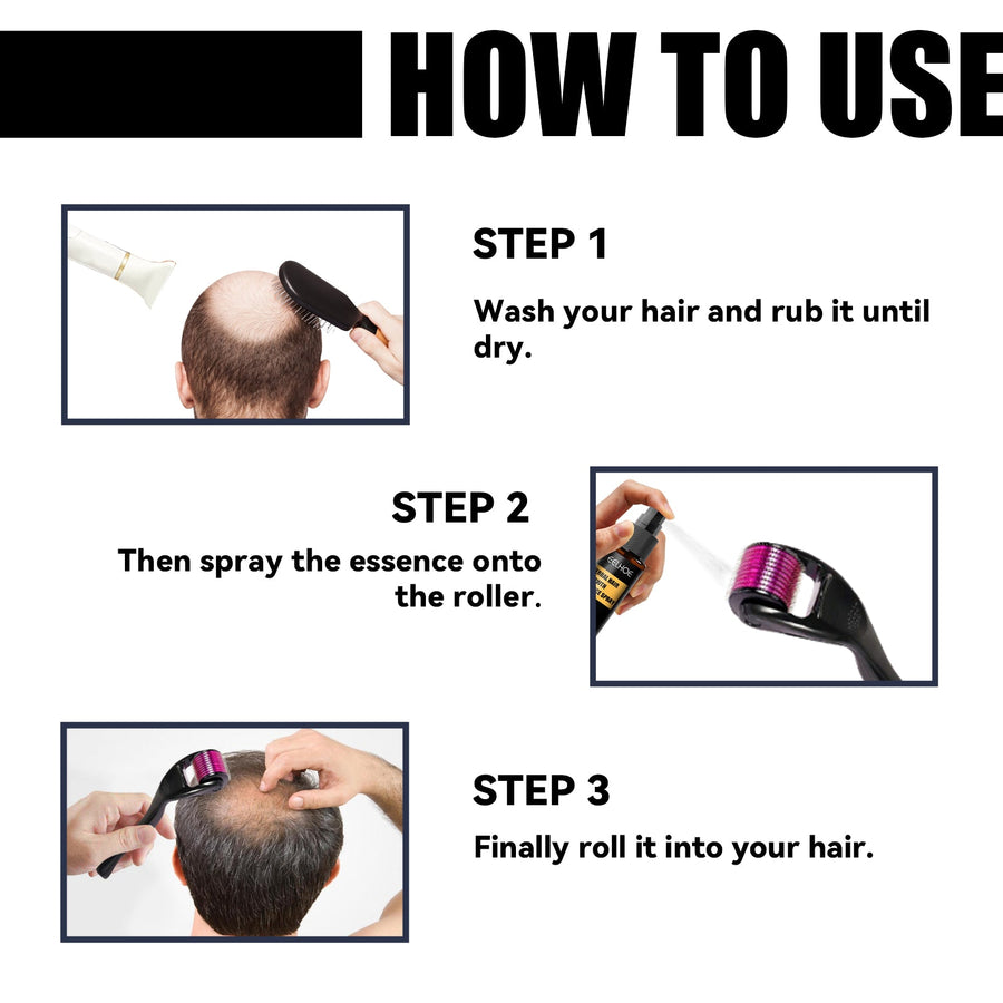 Herbal Scalp Spray & Roller for Dry, Thinning Hair
