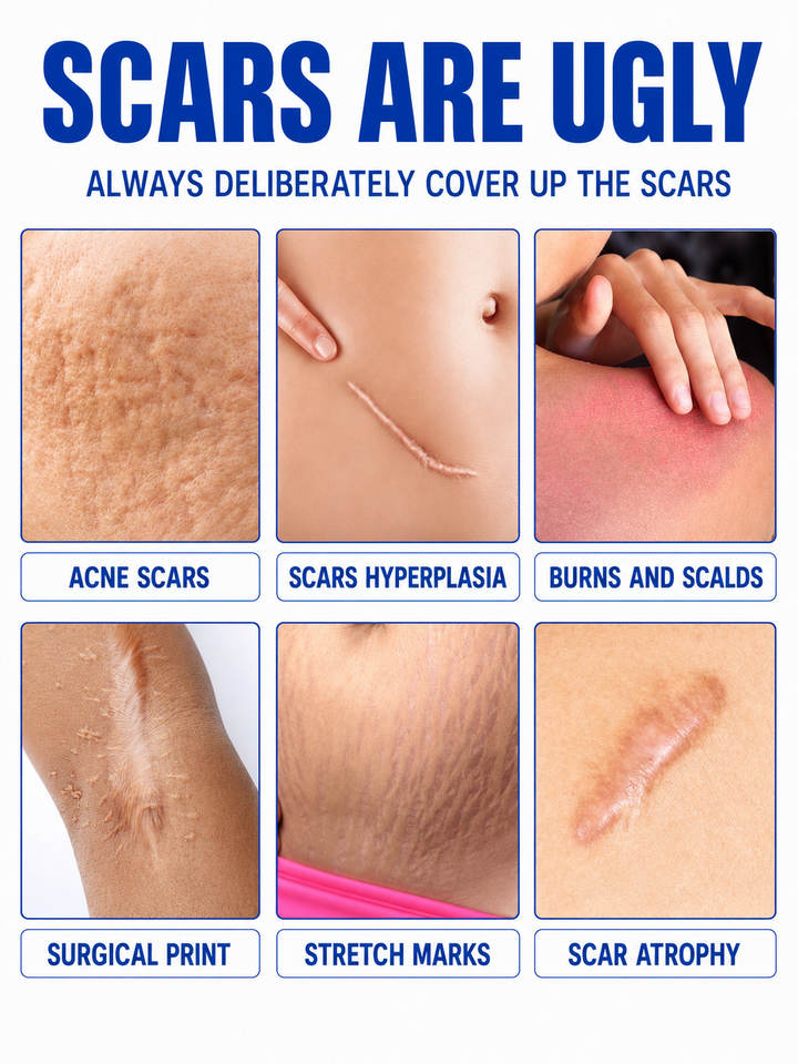 Jaysuing Scar Cream — Clinical Scar Removal Treatment