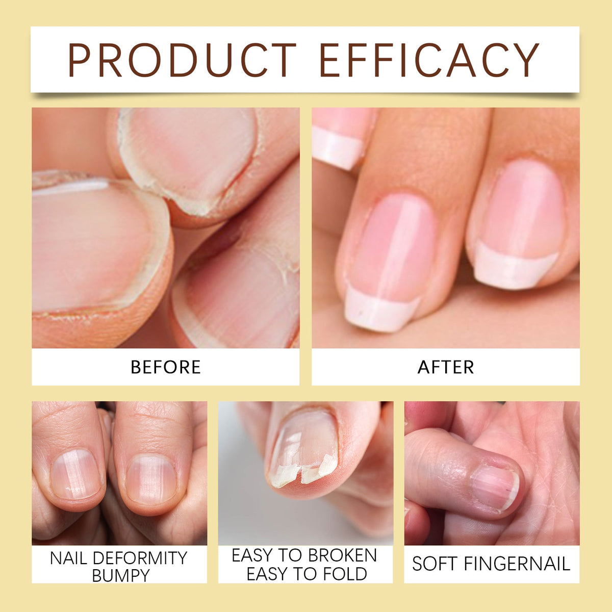 Jojoba Oil for Nails: Softens Cuticles & Restores Shine