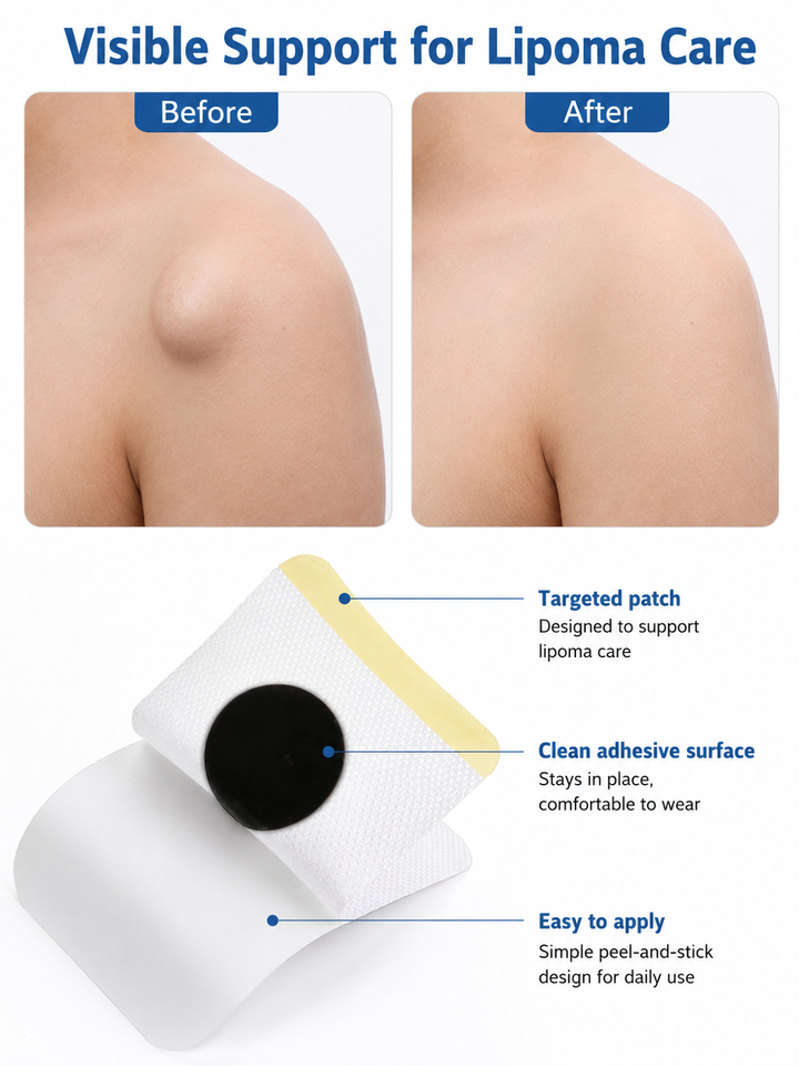Lipoma Removal Patch — Dissolve Subcutaneous Lumps Naturally