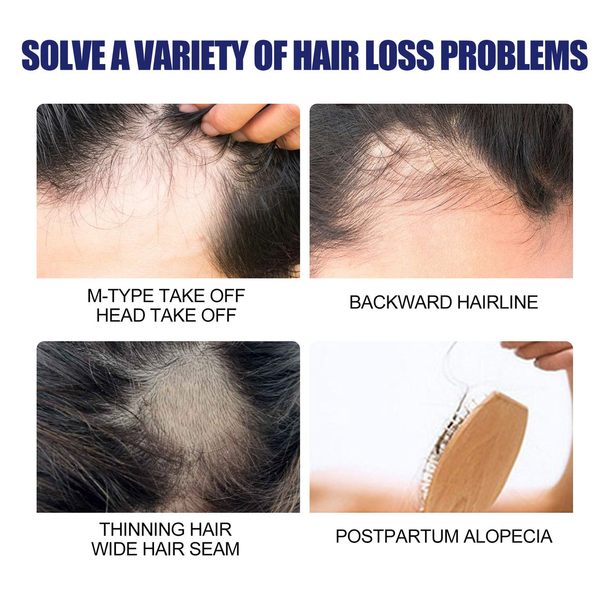 Men's Hair Growth Foam with Biotin for Thicker Hair