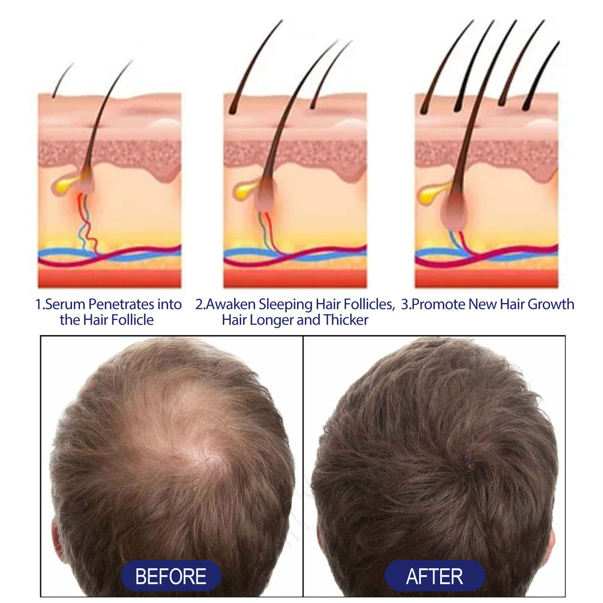 Men's Hair Growth Foam with Biotin for Thicker Hair