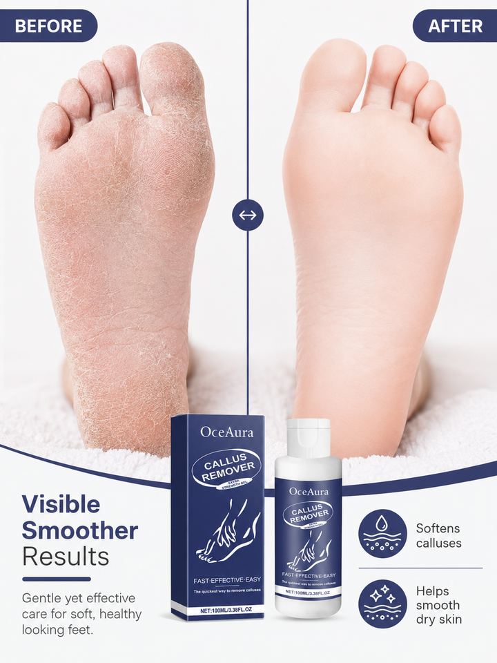 OceAura Foot Callus Remover Gel — Deep Repair 100ml