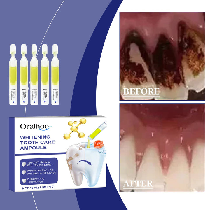 Teeth Whitening Serum Ampoules for Surface Stain Care