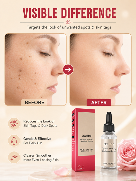 Organic Skin Tag Removal Serum – Clear, Smooth Skin in Weeks