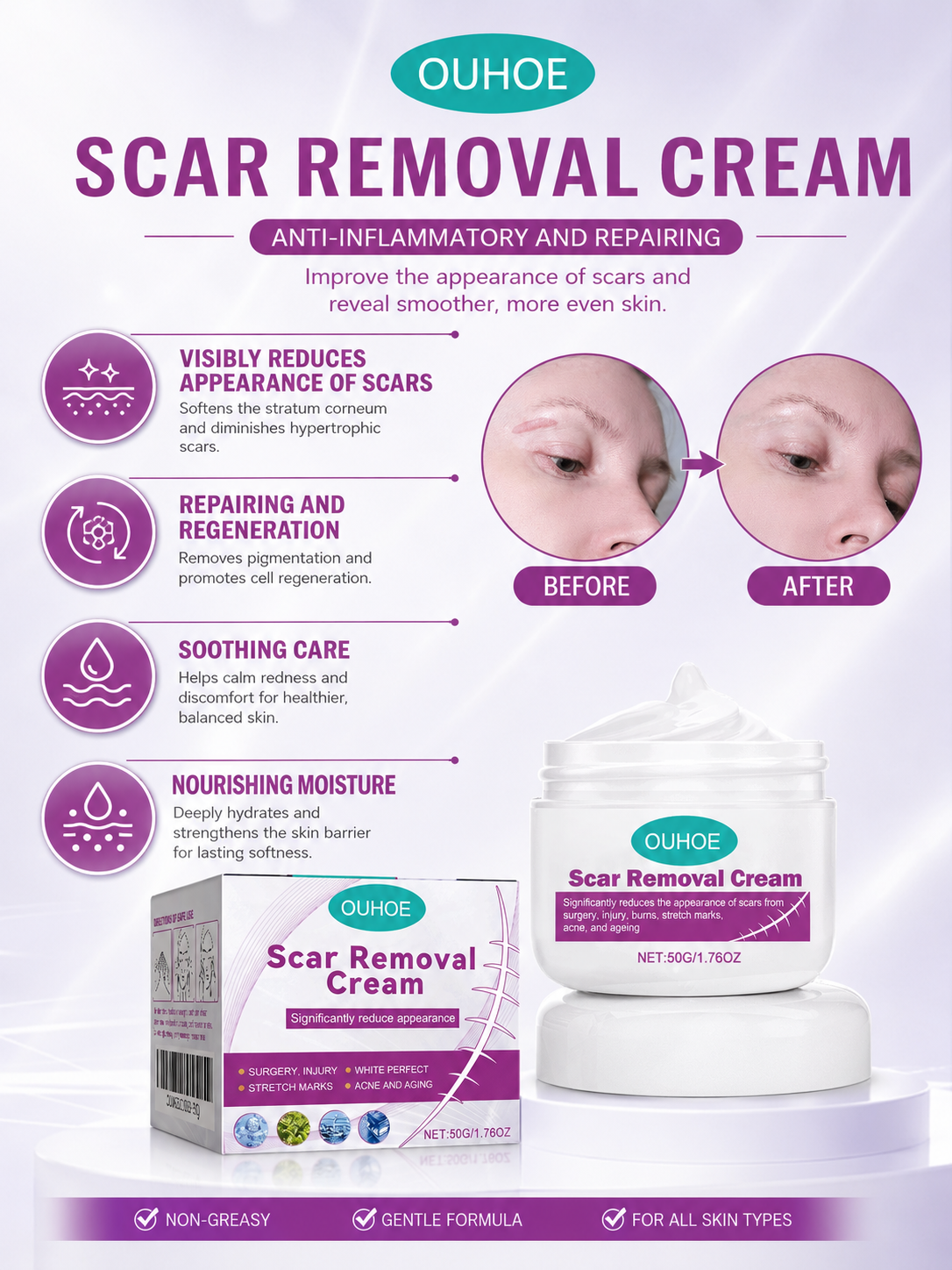 OUHOE Scar Removal Cream 50g — Face & Body Treatment