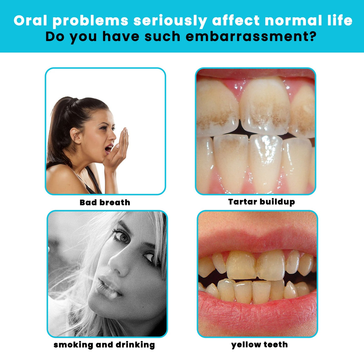 Teeth Whitening Mousse for Stains and Fresh Breath Care