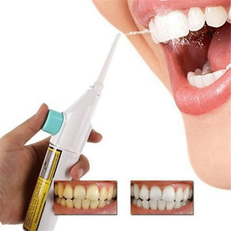 Cordless Water Flosser for Braces and Between Teeth