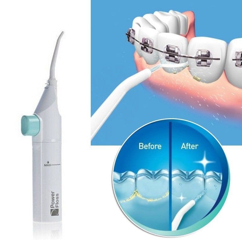 Cordless Water Flosser for Braces and Between Teeth