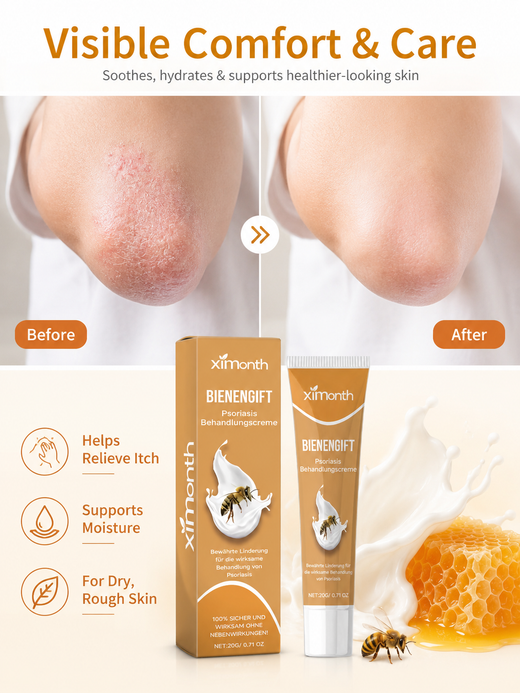 Psoriasis Cream with Bee Venom – Soothes Itch & Repairs Skin