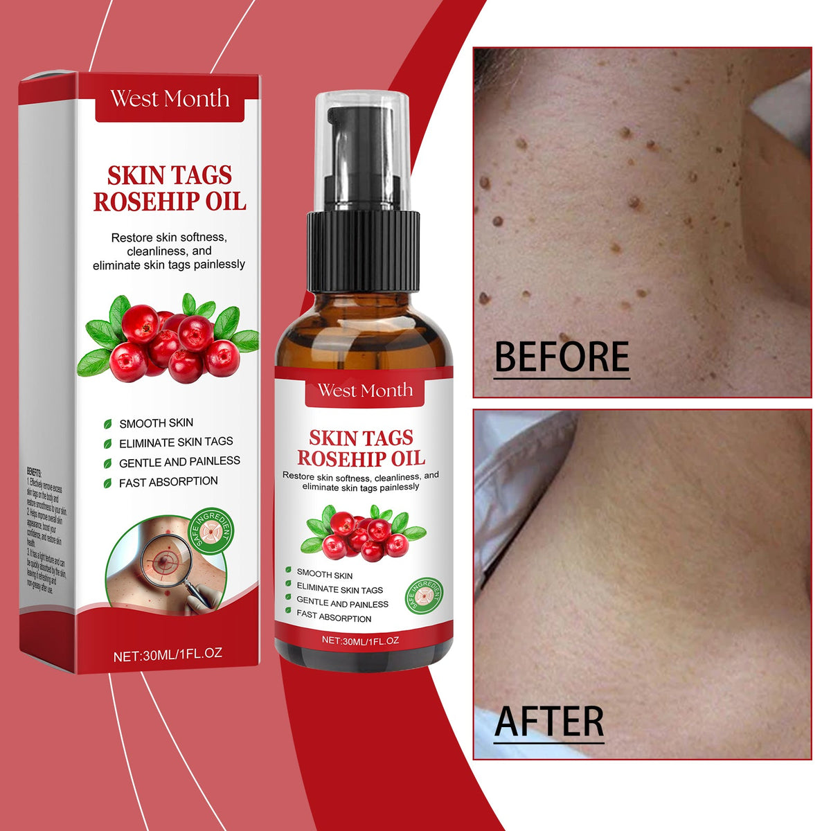 Rosehip Skin Tag Oil With Tea Tree & Hyaluronic Acid