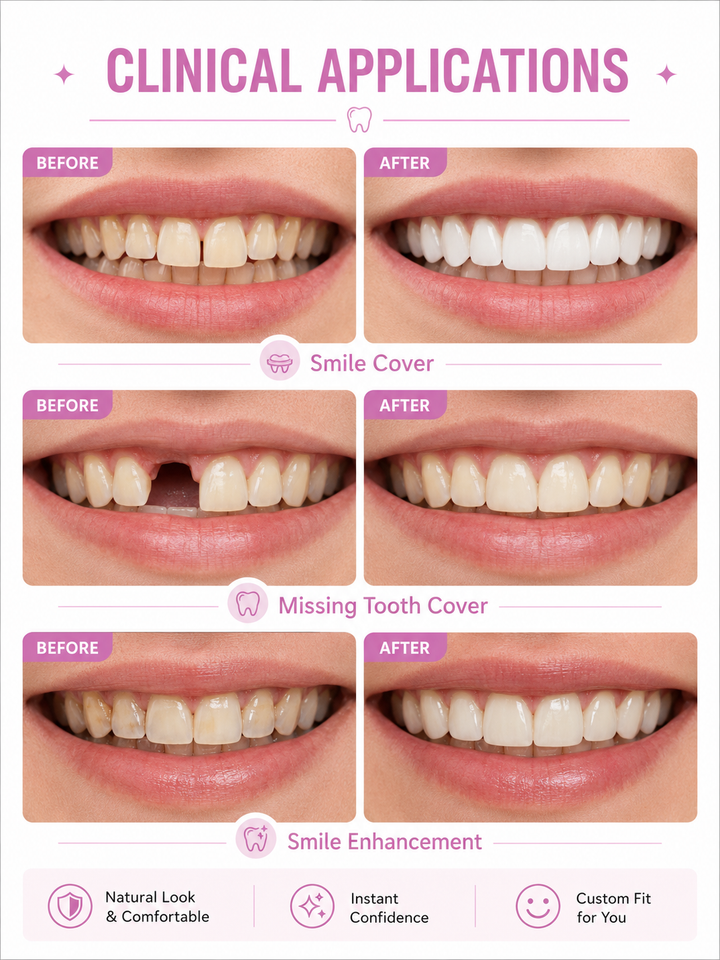 Simulation Braces Smile Whitening — 6th Gen Dental Arch Set