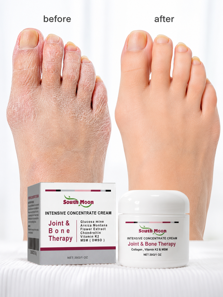 Joint & Bone Therapy Cream — Visible Swelling Reduction