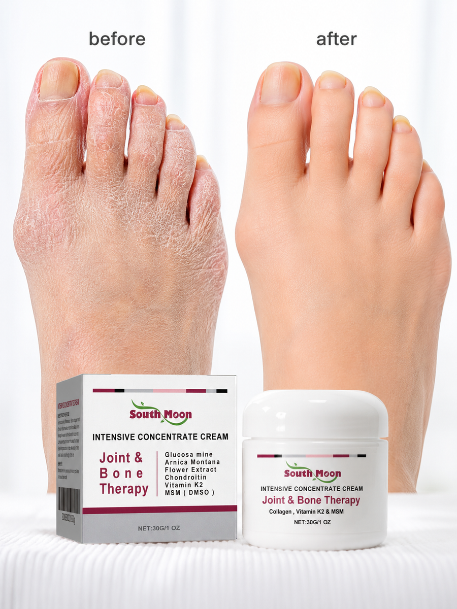 Joint & Bone Therapy Cream — Visible Swelling Reduction