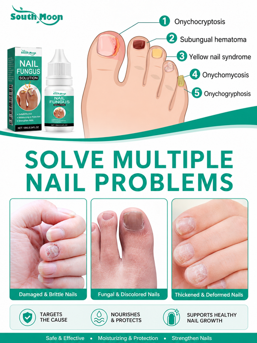South Moon Nail Essence for Discolored, Brittle Nails