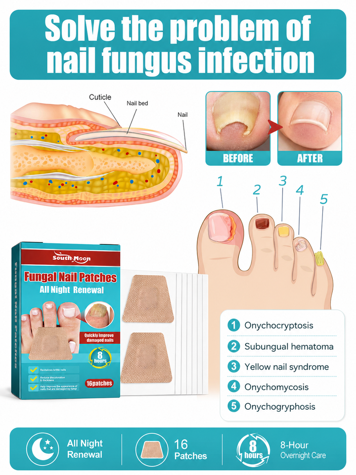 South Moon Nail Night Patch – 8-Hour Fungal Treatment