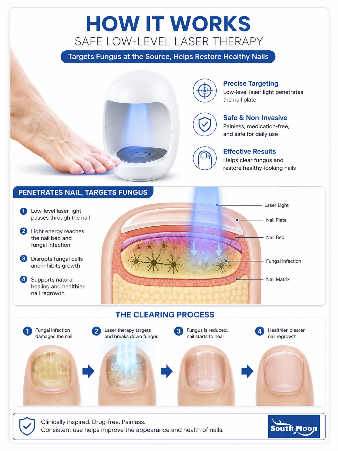 South Moon Phototherapy Nail Care Device