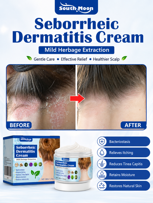 South Moon Scalp Cream for Seborrheic Dermatitis Relief