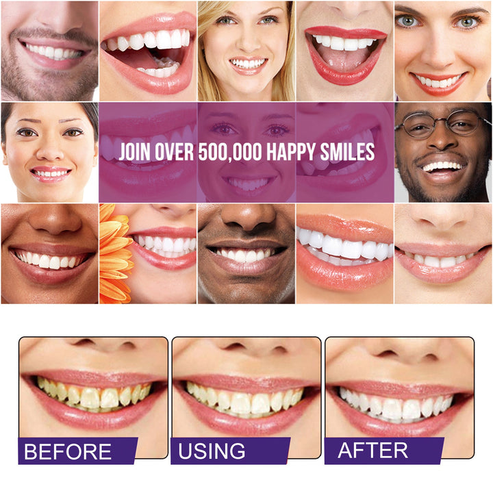 Teeth Whitening Mousse for a Brighter-Looking Smile
