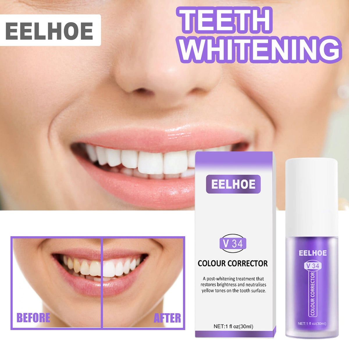 V34 Colour Corrector for a Brighter-Looking Smile