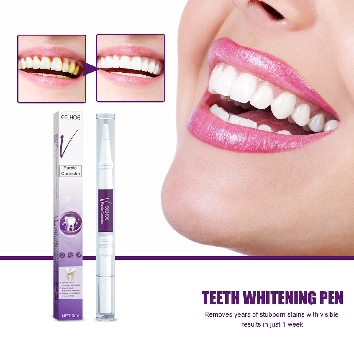 V34 Purple Teeth Whitening Pen for Brighter Smiles