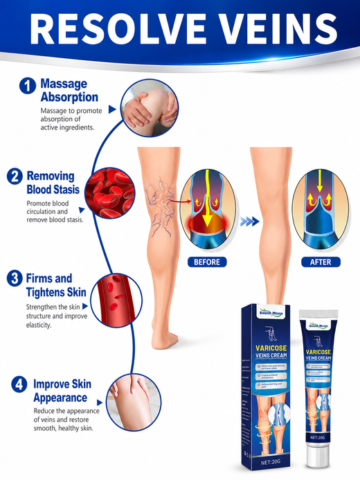 Varicose Vein Cream — Visible Vein Reduction in 2 Weeks