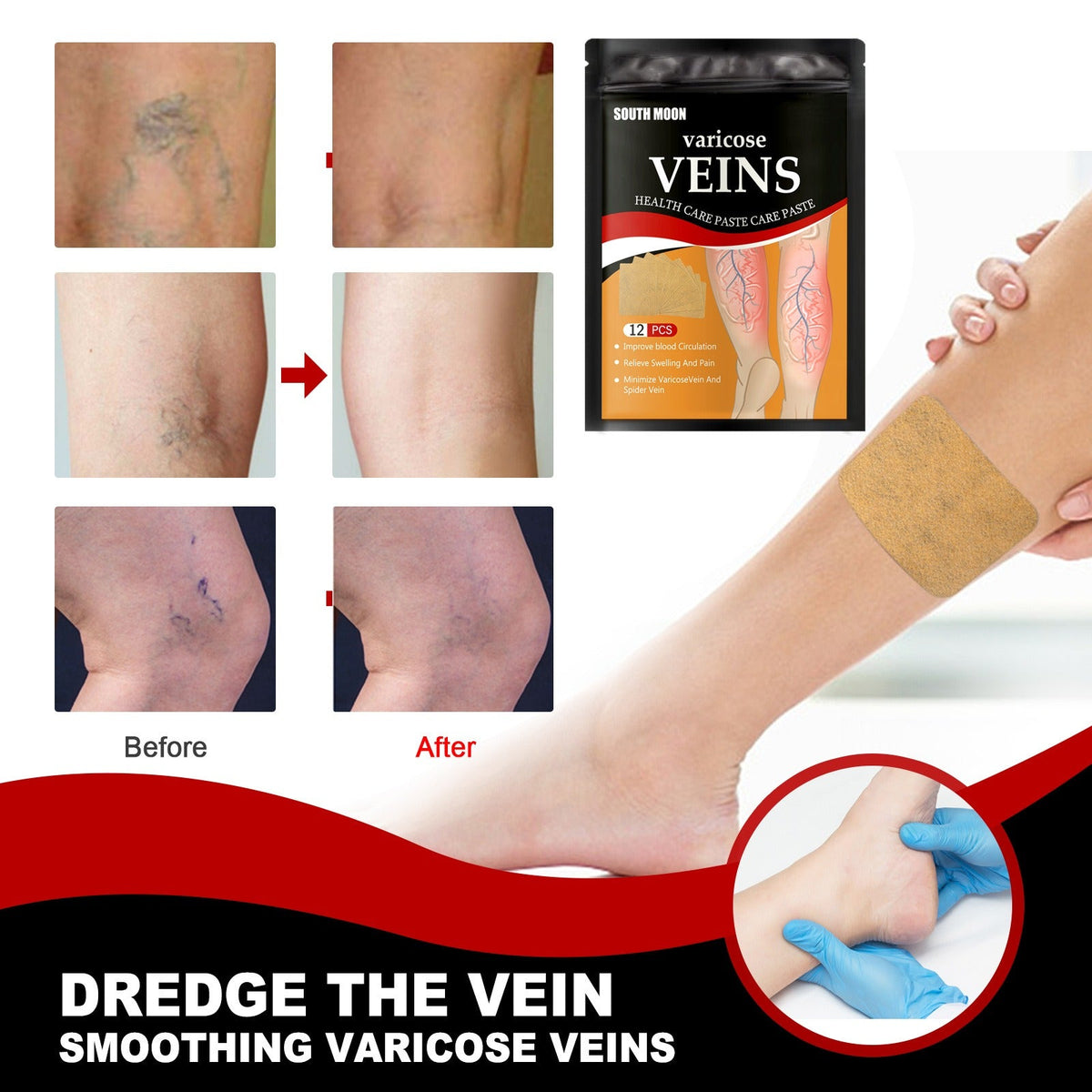 Cold Compress Leg Vein Patches, 12 Count for Tired Legs