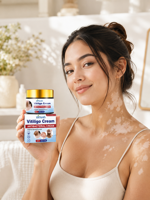 Vitiligo Cream — Stimulates Pigment Restoration & Deep