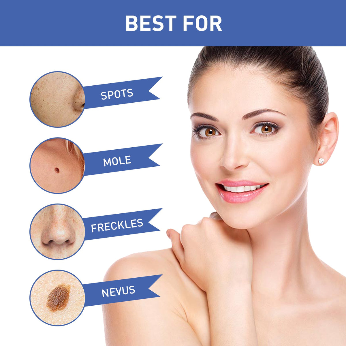 Herbal Wart and Skin Tag Remover Cream with Tea Tree Oil
