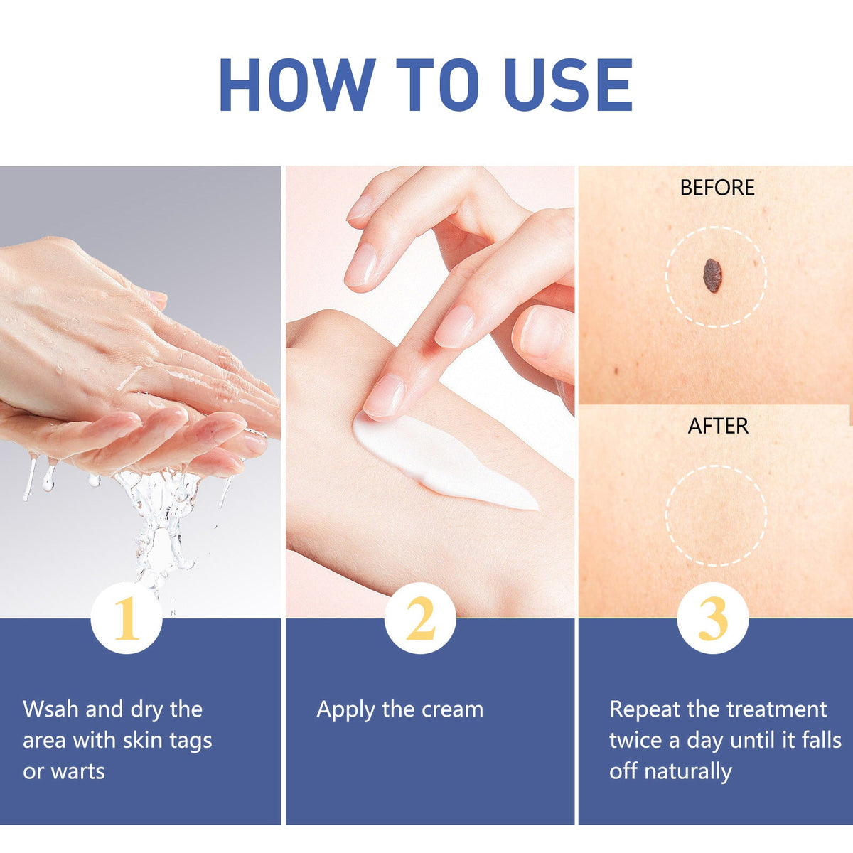Herbal Wart and Skin Tag Remover Cream with Tea Tree Oil