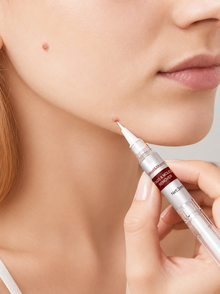 Kew Pen Skin Tag & Wart Remover — Gone in 5 Days