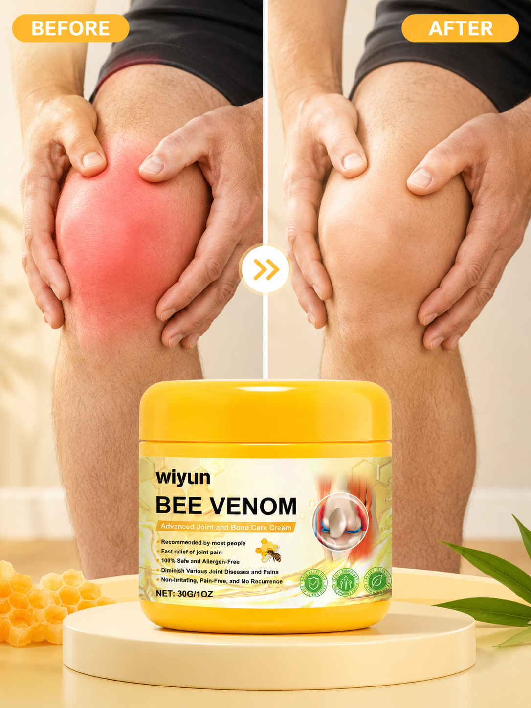 Wiyun Bee Venom Joint Cream — Natural Pain Relief