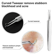 Professional Blackhead Tweezers - wanelo - store - roman
