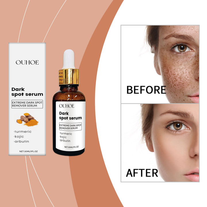 Facial Moisturizing Essence – Gentle, Lasting Hydration