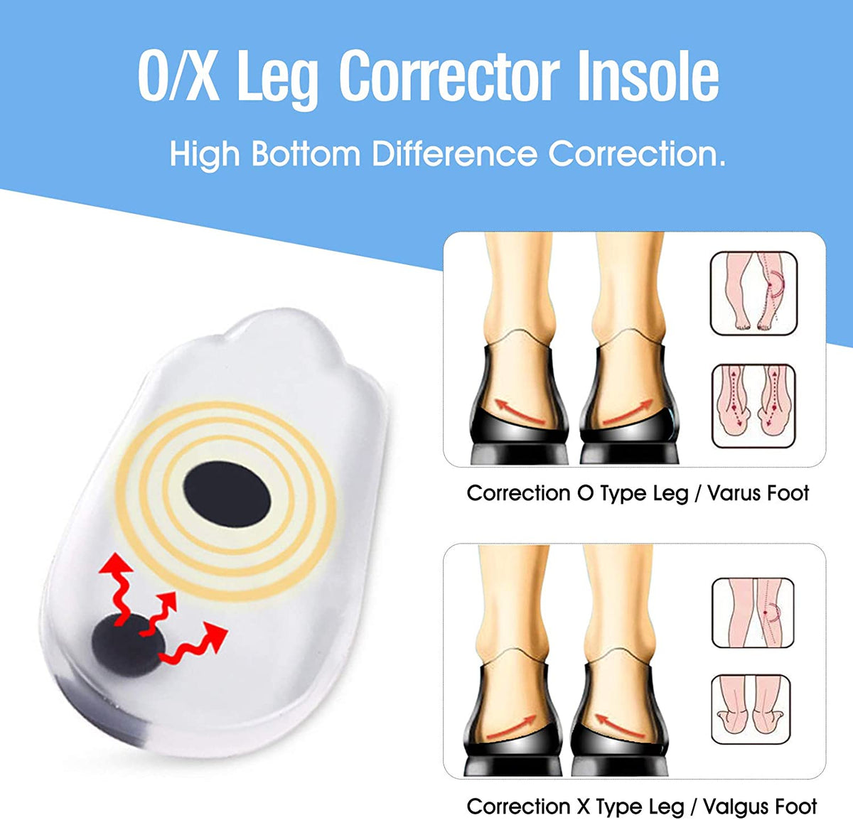 O/X Leg Corrector Insoles — Visible Leg Straightening
