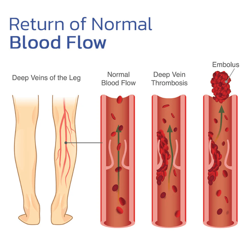 EMS bioelectric acupoints massager mat - wanelo - store - roman
